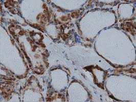 m01404 1 anti ivd mouse monoclonal antibody clone id oti1b10 ihc testing 3