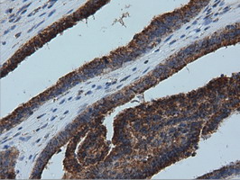 m01404 1 anti ivd mouse monoclonal antibody clone id oti1b10 ihc testing 4