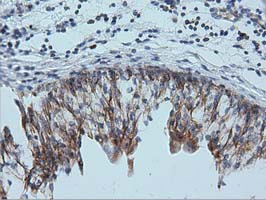 m01404 1 anti ivd mouse monoclonal antibody clone id oti1b10 ihc testing 6