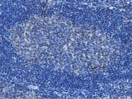 m01404 1 anti ivd mouse monoclonal antibody clone id oti1b10 ihc testing 8