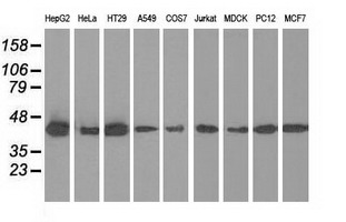 m01404 1 anti ivd mouse monoclonal antibody clone id oti1b10 wb testing 2