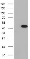 HEK293T cells were transfected with the pCMV6-ENTRY control (Left lane) or pCMV6-ENTRY IVD (Right lane) cDNA for 48 hrs and lysed