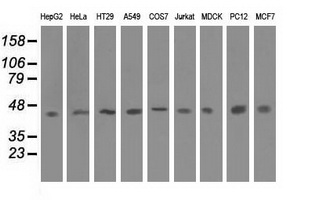 Western blot analysis of extracts (35ug) from 9 different cell lines by using anti-IVD monoclonal antibody