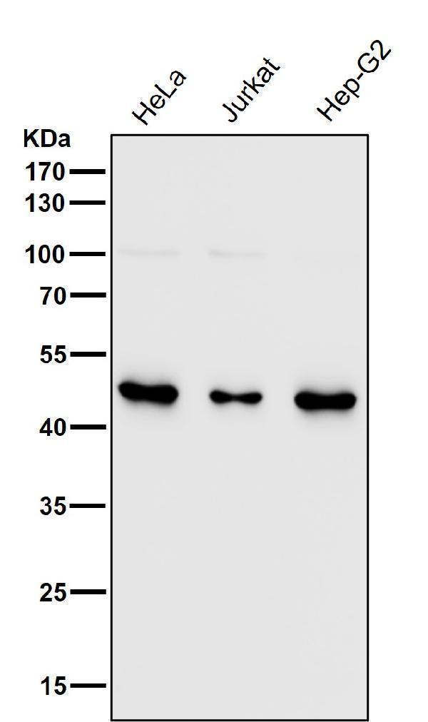 All lanes use the Antibody at 1:5k dilution for 1 hour at room temperature