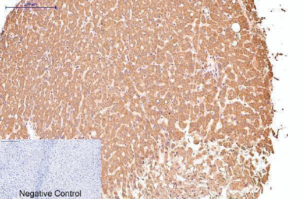 Immunohistochemical analysis of paraffin-embedded Human-liver tissue