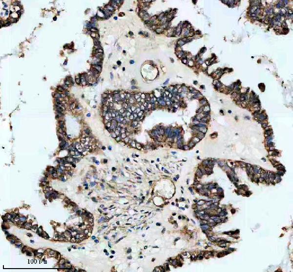 m01409 txnip primary antibodies ihc testing 2