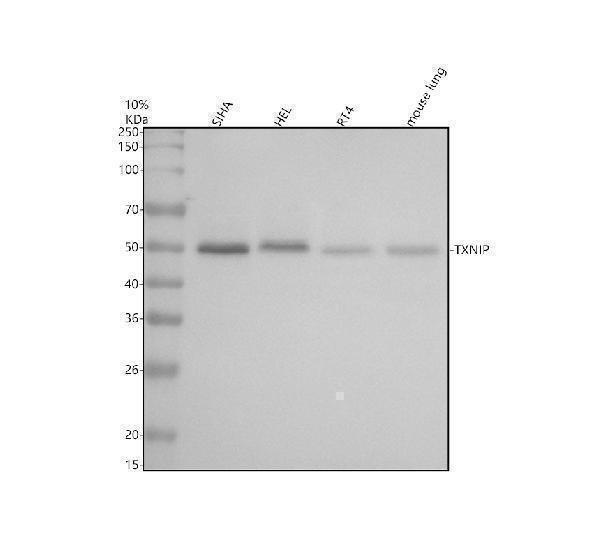 m01409 txnip primary antibodies wb testing 1