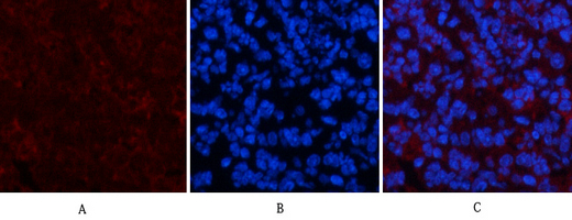 m01411 1 col4a1 primary antibodies if testing 1