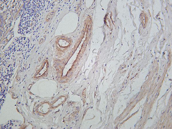 m01411 2 col4a1 primary antibodies ihc testing 1