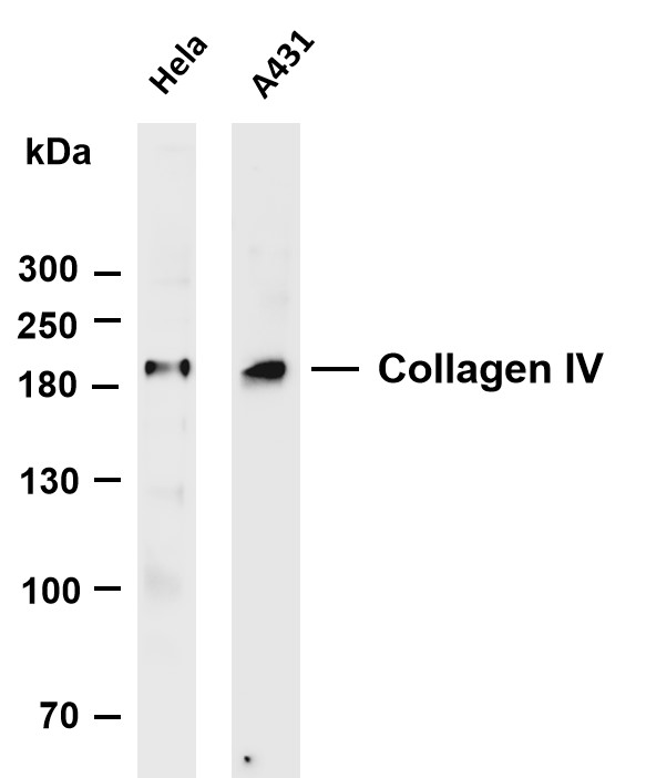 m01411 2 col4a1 primary antibodies wb testing 1