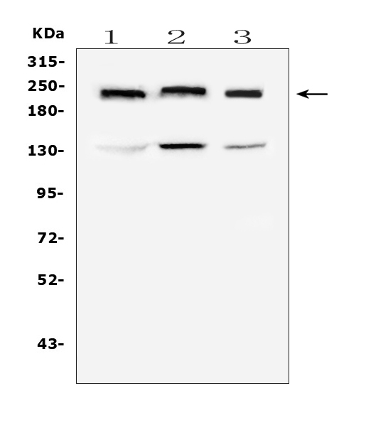 Western blot analysis of Collagen IV using anti-Collagen IV antibody (M01411). Electrophoresis was performed on a 8% SDS-PAGE gel at 70V (Stacking gel) / 90V (Resolving gel) for 2-3 hours. The sample well of each lane was loaded with 50ug of sample under reducing conditions. Lane 1: human HEK293T whole cell lysate, Lane 2: human Hela whole cell lysate, Lane 3: human A549 whole cell lysate. After Electrophoresis, proteins were transferred to a Nitrocellulose membrane at 150mA for 50-90 minutes. Blocked the membrane with 5% Non-fat Milk/ TBS for 1.5 hour at RT. The membrane was incubated with mouse anti-Collagen IV antigen affinity purified monoclonal antibody (Catalog # M01411) at 0.5 μg/mL overnight at 4°C, then washed with TBS-0.1%Tween 3 times with 5 minutes each and probed with a goat anti-mouse IgG-HRP secondary antibody at a dilution of 1:10000 for 1.5 hour at RT. The signal is developed using an Enhanced Chemiluminescent detection (ECL) kit (Catalog # EK1001) with Tanon 5200 system. A specific band was detected for Collagen IV at approximately 220KD. The expected band size for Collagen IV is at 161KD.