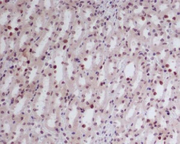 m01415 ihc
