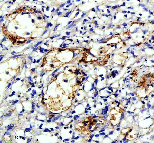 IHC analysis of APOC3 using anti-APOC3 antibody (M01416)