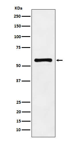 Western blot analysis of PAK2 expression in HeLa cell lysate