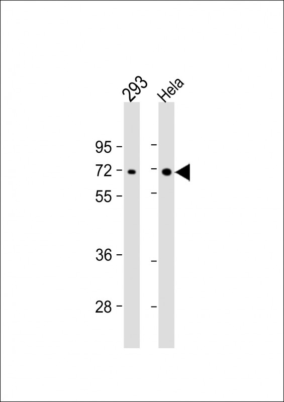 All lanes : Anti-PRKAA2 Antibody at 1:1000 dilutionLane 1: 293 whole cell lysateLane 2: Hela whole cell lysateLysates/proteins at 20 µg per lane