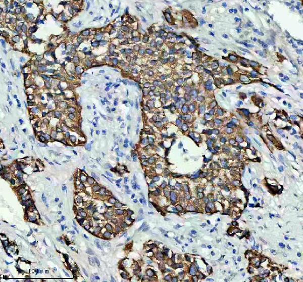 m01421 2 krt8 primary antibodies ihc testing 1