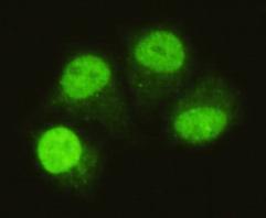 Immunocytochemistry of HeLa cells using anti- SMAD5 (C-terminus) antibody diluted 1:75