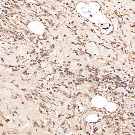 Immunohistochemical analysis of paraffin-embedded Human Hodgkin