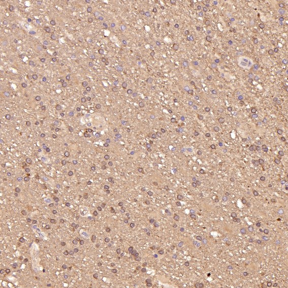 m01423 ihc8