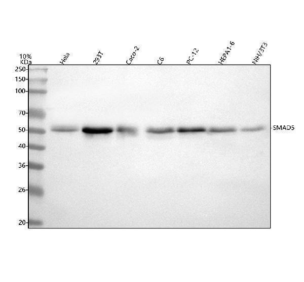  Western blot analysis of Smad5 using anti-Smad5 antibody (M01423)