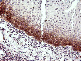 m01425 anti il6r mouse monoclonal antibody clone id oti2f4 ihc testing 2