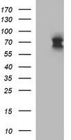 m01425 anti il6r mouse monoclonal antibody clone id oti2f4 wb testing 1