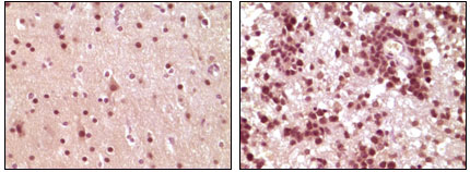 m01426 1 elk1 primary antibodies ihc testing 1