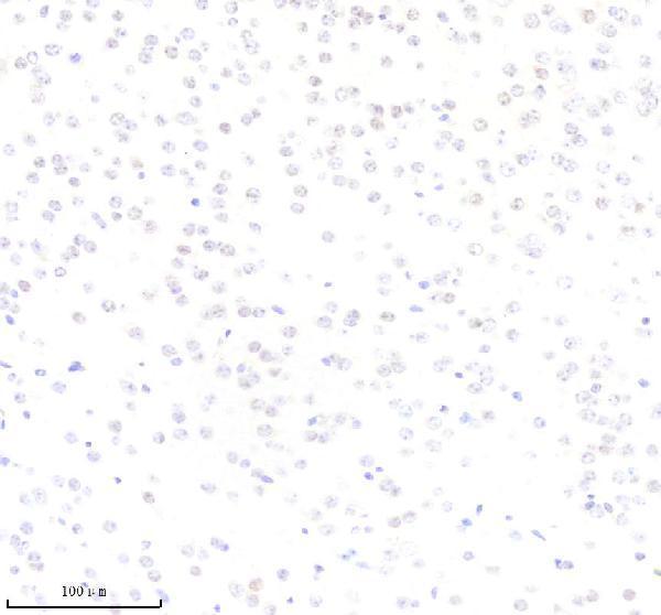 m01426 elk1 primary antibodies ihc testing 2