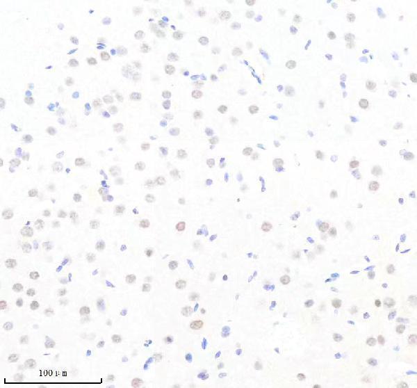 m01426 elk1 primary antibodies ihc testing 3