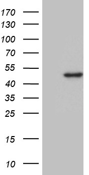 HEK293T cells were transfected with the pCMV6-ENTRY control (Left lane) or pCMV6-ENTRY DDB2 (Right lane) cDNA for 48 hrs and lysed
