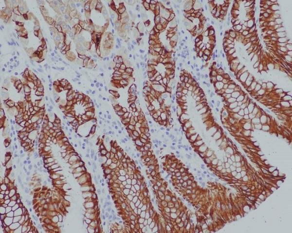 Immunohistochemical analysis of paraffin-embedded human stomach, using Cytokeratin 14 Antibody