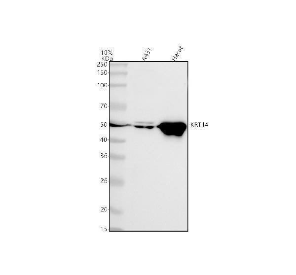  Western blot analysis of KRT14 using anti-KRT14 antibody (M01432-2)