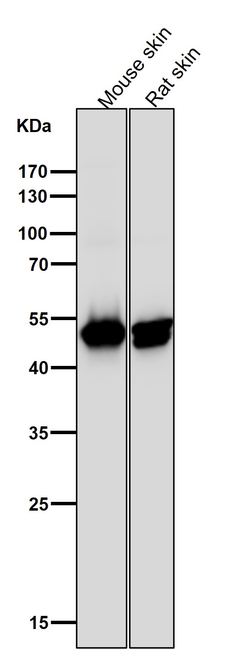 All lanes use the Antibody at 1:1W dilution for 1 hour at room temperature