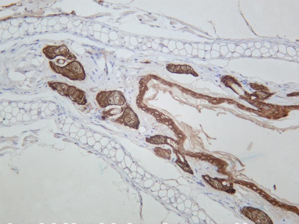 Mouse skin was stained with anti-Cytokeratin 14 rabbit antibody
