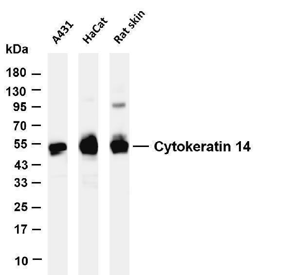 Various whole cell lysates were separated by 4-20% SDS-PAGE, and the membrane was blotted with anti-Cytokeratin 14 antibody