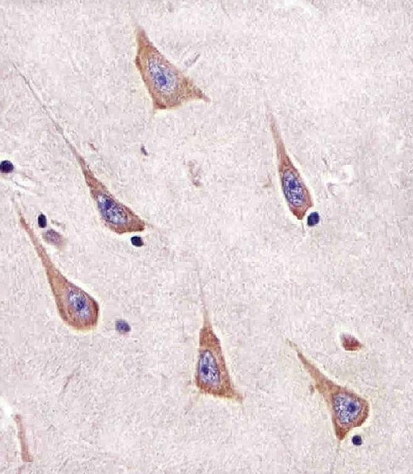 m01436 1 anti rab11a antibody ihc p testing 2