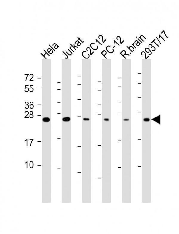 m01436 1 anti rab11a antibody wb testing 1