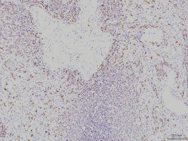  IHC analysis of Rab11A using anti-Rab11A antibody (M01436-2)