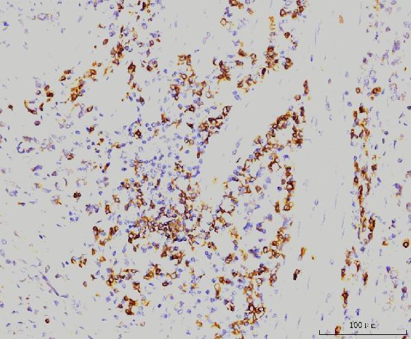  IHC analysis of Rab11A using anti-Rab11A antibody (M01436-2)