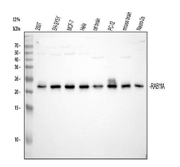  Western blot analysis of Rab11A using anti-Rab11A antibody (M01436-2)