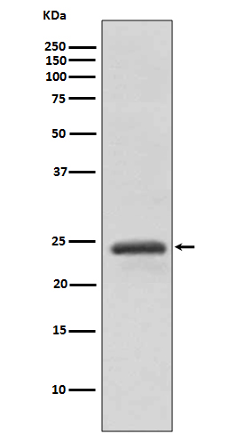 Western blot analysis of RAB11A expression in HeLa cell lysate