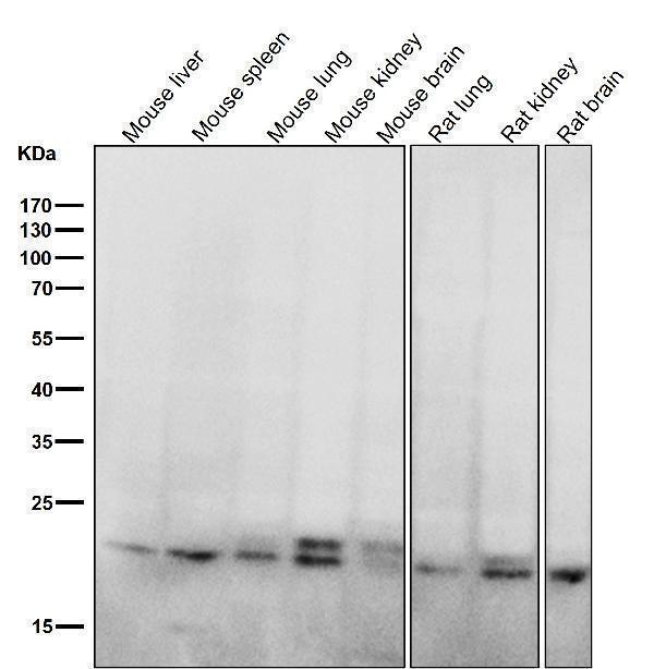 All lanes use the Antibody at 1:5K dilution for 1 hour at room temperature
