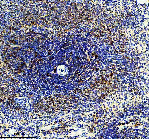 IHC analysis of TNFR2/TNFRSF1B using anti-TNFR2/TNFRSF1B antibody (M01437)