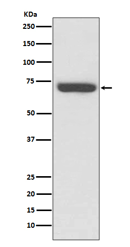 Western blot analysis of TNF Receptor II expression in Jurkat cell lysate