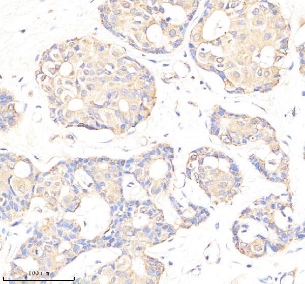  IHC analysis of C1QBP using anti-C1QBP antibody (M01439-1)