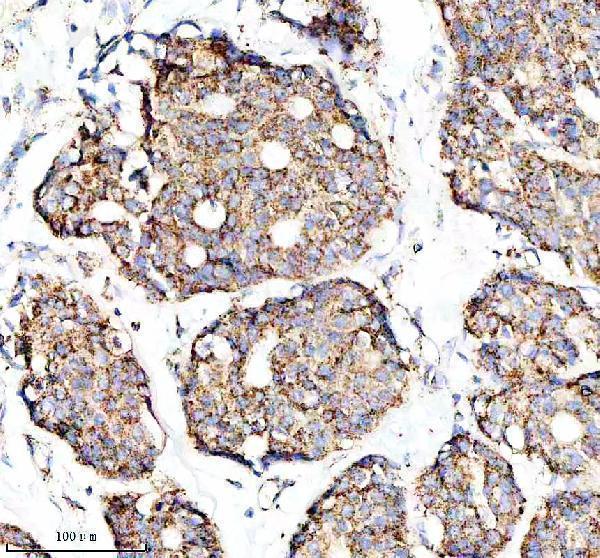  IHC analysis of C1QBP using anti-C1QBP antibody (M01439)