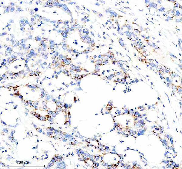 m01439 c1qbp primary antibodies ihc testing 3