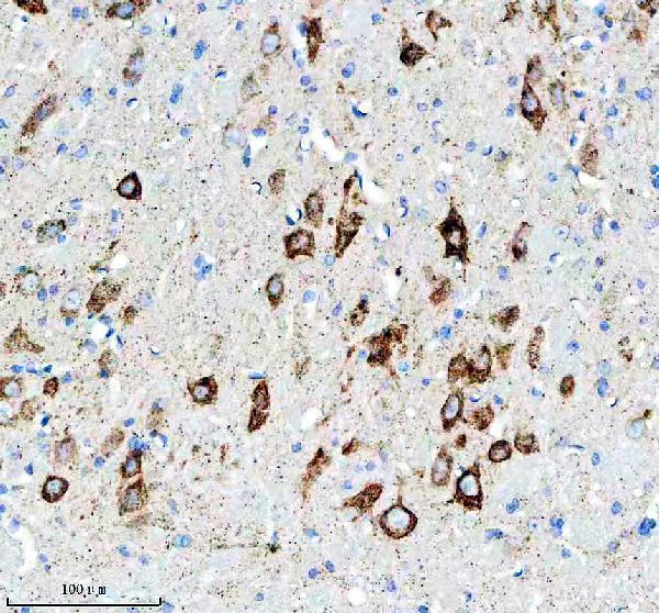 m01439 c1qbp primary antibodies ihc testing 4