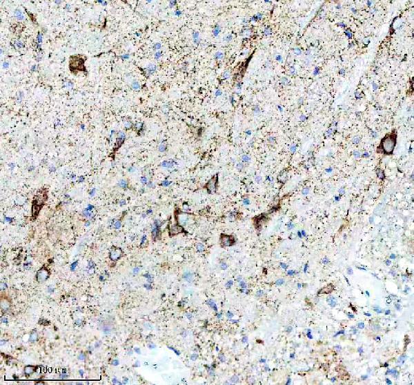 m01439 c1qbp primary antibodies ihc testing 5