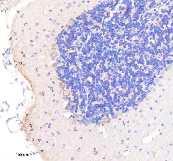 m01439 c1qbp primary antibodies ihc testing 6
